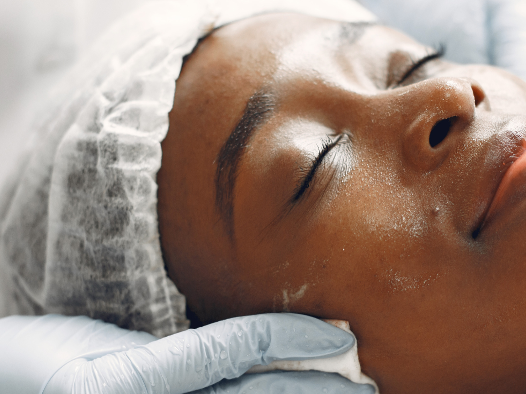 Limpeza de pele de 50 minutos por R$ 99,90 - Foto 3